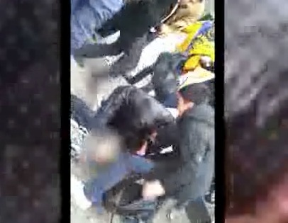 rottweiler attacks child graphic rottweiler attacks child rtm rightthisminute rottweiler attacks child graphic rottweiler attacks child rtm rightthisminute