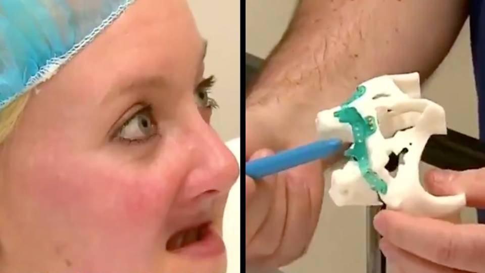 Cancer Survivor Gets 3d Printed Jaw Rtm Rightthisminute
