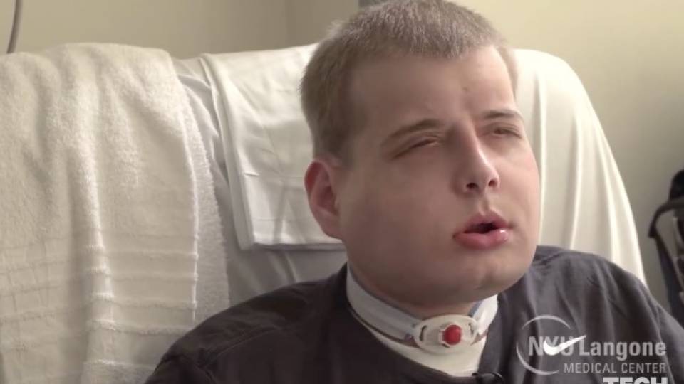 U.S. Firefighter Patrick Hardison Receives 'Most Extensive' Face