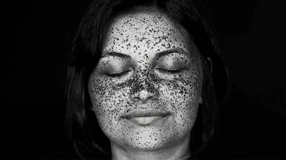 UV Camera Reveals Invisible Skin Damage RTM RightThisMinute