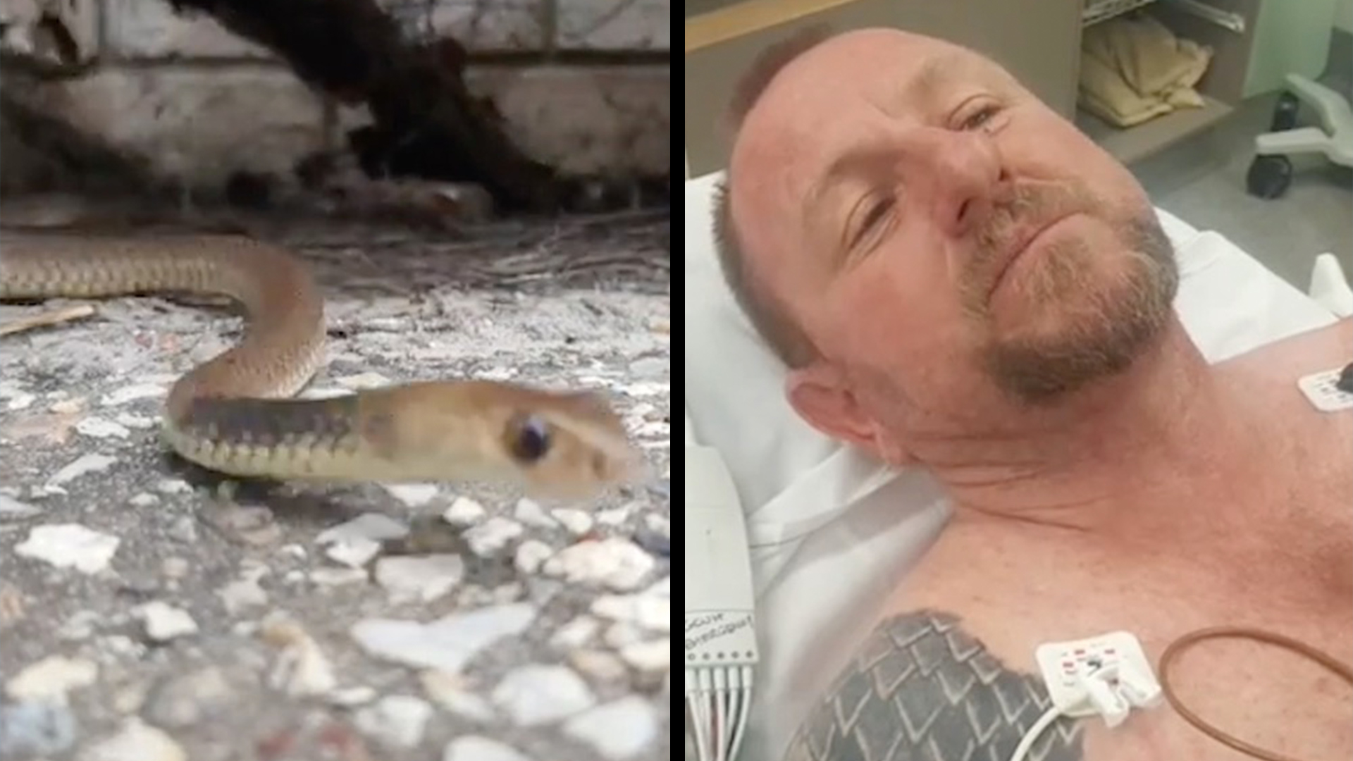 How Deadly Is A Rattlesnake Bite Man Barely Survives Venomous Snake Bite | RTM - RightThisMinute