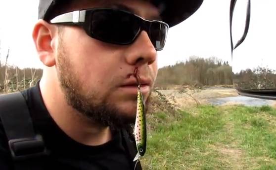 Bilderesultat for people hurt with fish hook