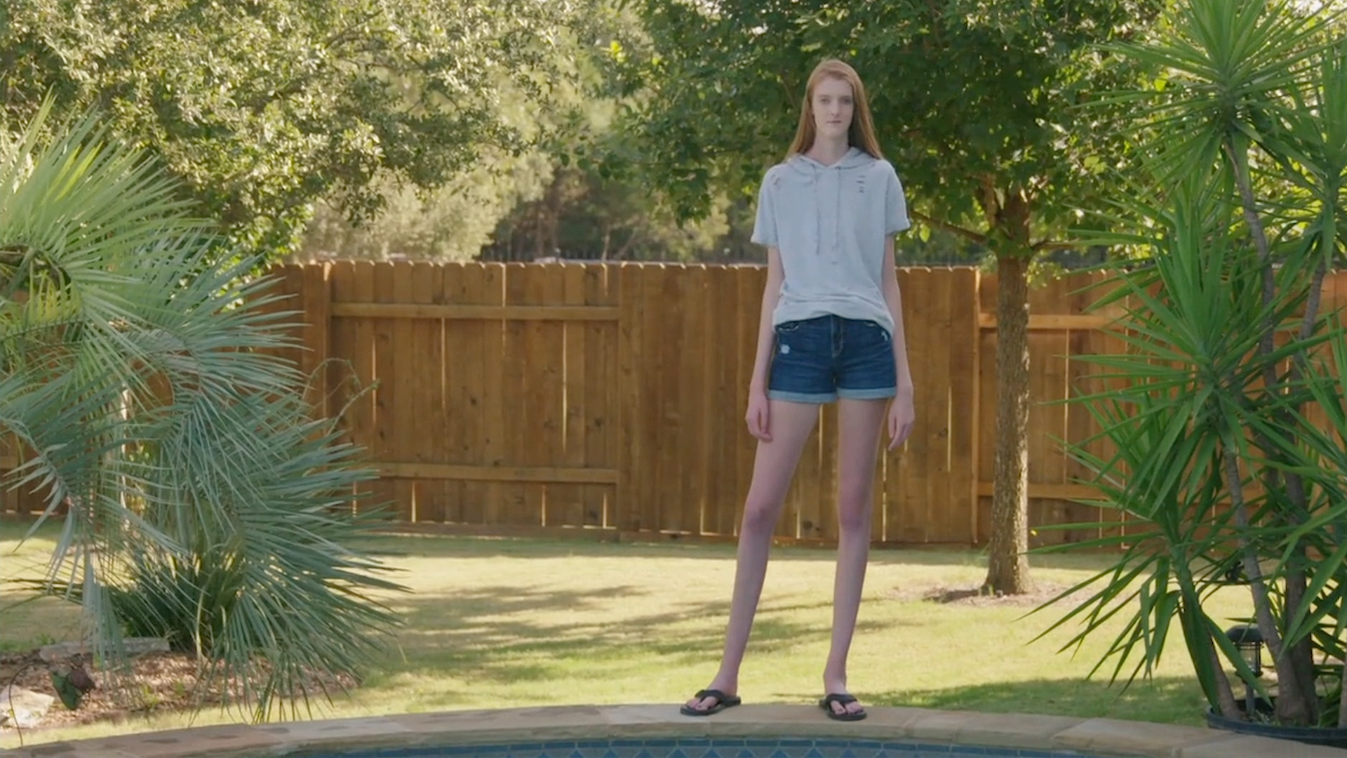 16-Year-Old Girl Has World's Longest Legs | RTM ...